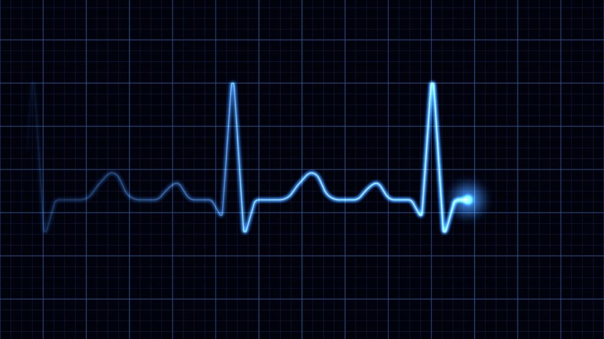 Thorough preoperative cardiac evaluation is crucial.